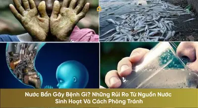 Nước Bẩn Gây Bệnh Gì? Những Rủi Ro Từ Nguồn Nước Sinh Hoạt Và Cách Phòng Tránh