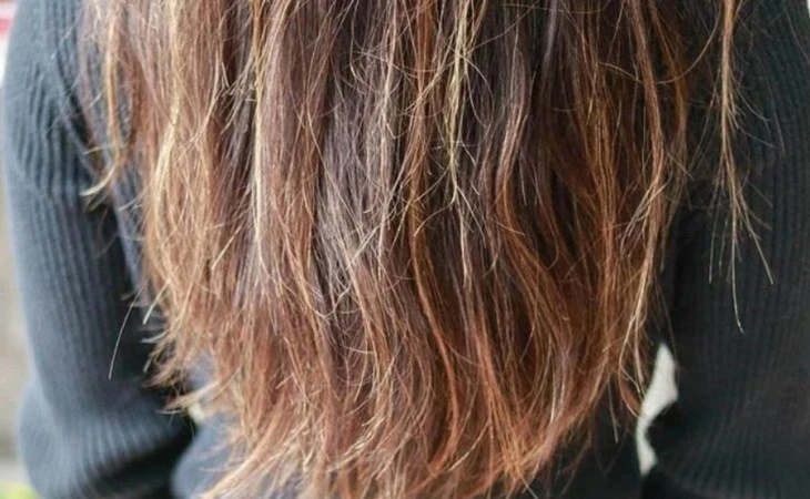 Nước cứng gây hại làm tóc khô xơ và dễ gãy rụng
