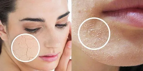 Clo dư trong nước máy – 